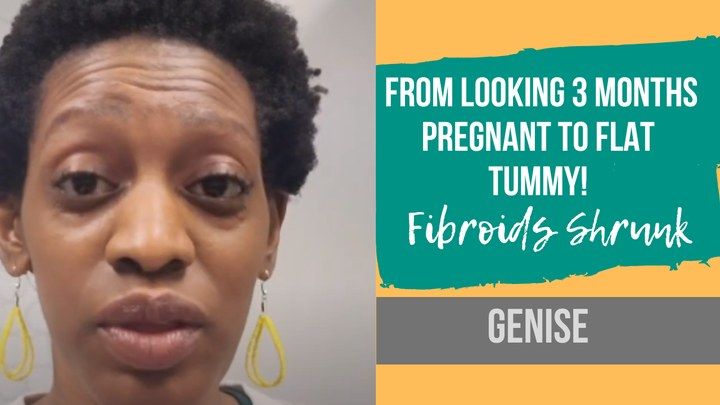 Genise, from looking 3 months pregnant to flat tummy, fibroids shrunk
